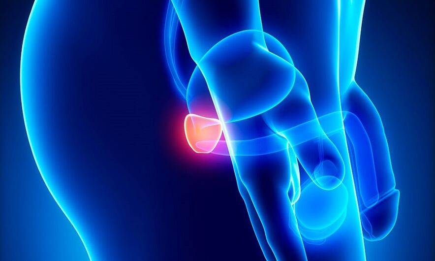 inflamacioni i prostatës me prostatit